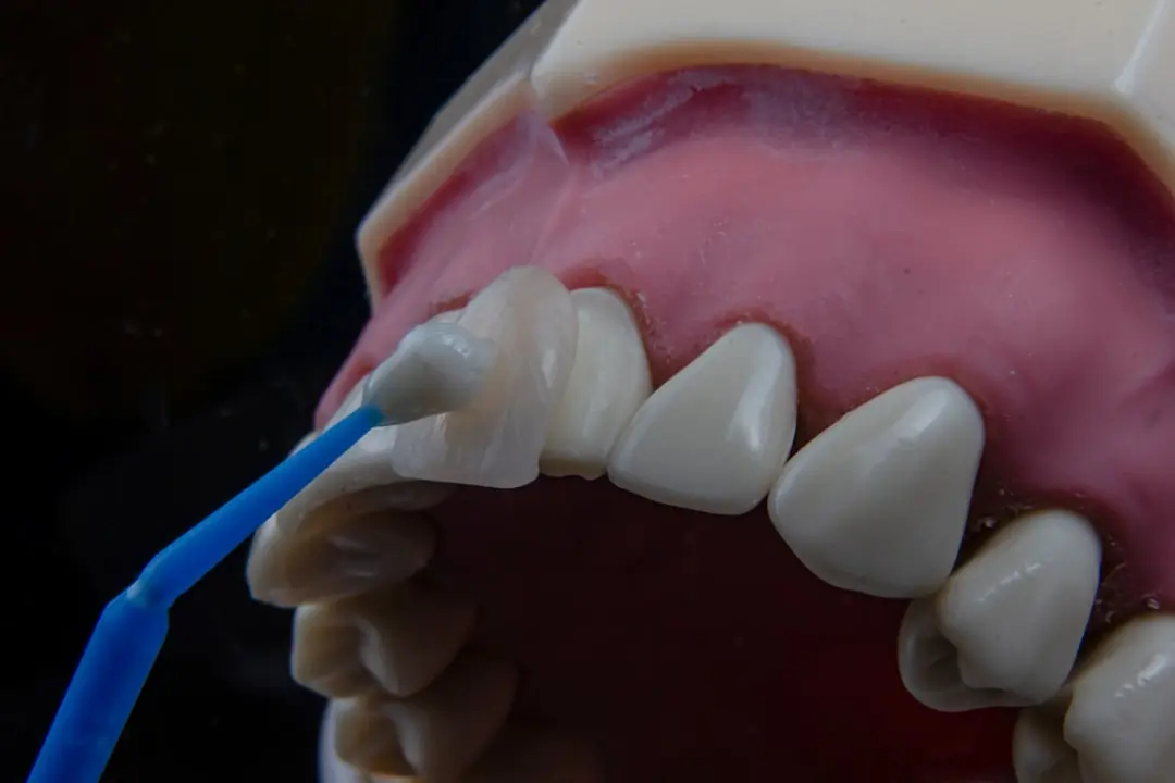 Senac inscreve para o curso Técnico em Prótese Dentária em São Paulo e Campinas